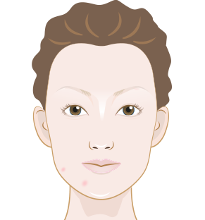 How to fix dry skin on eyelids