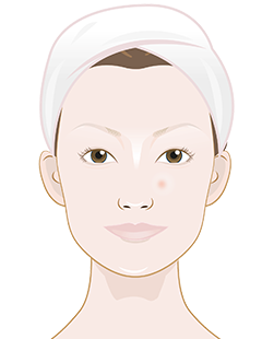Is hyaluronic acid good for dry skin