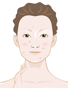 Best toners for dry skin hydration
