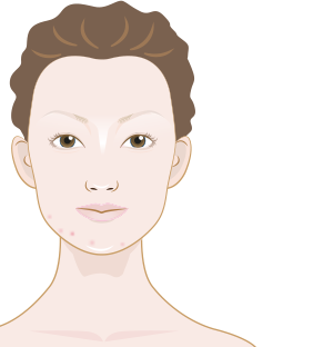 What is photo aging and how to prevent it