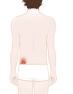 Compromised skin: Causes and solutions