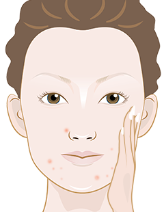 Causes of skin flaking on the face