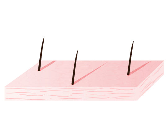 How to treat and prevent skin cracking