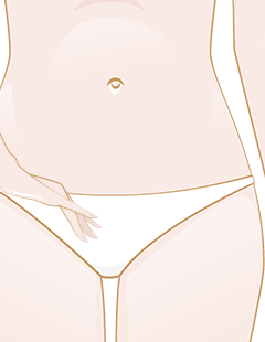 How to manage pube hair