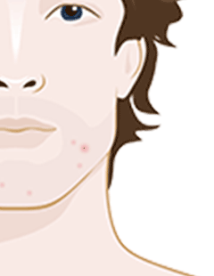 Best vitamin c serums for dry skin