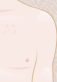 How to deal with itchy skin during pregnancy