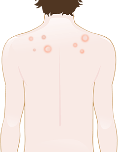 What is the skin barrier and why it matters