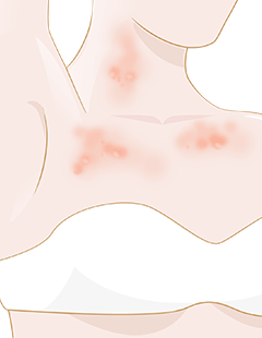 How anxiety causes itchy skin and remedies