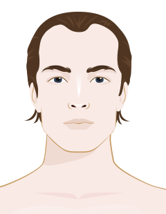 Hair Loss In Men - Do You Deal With A Receding Hairline? Get Help Here