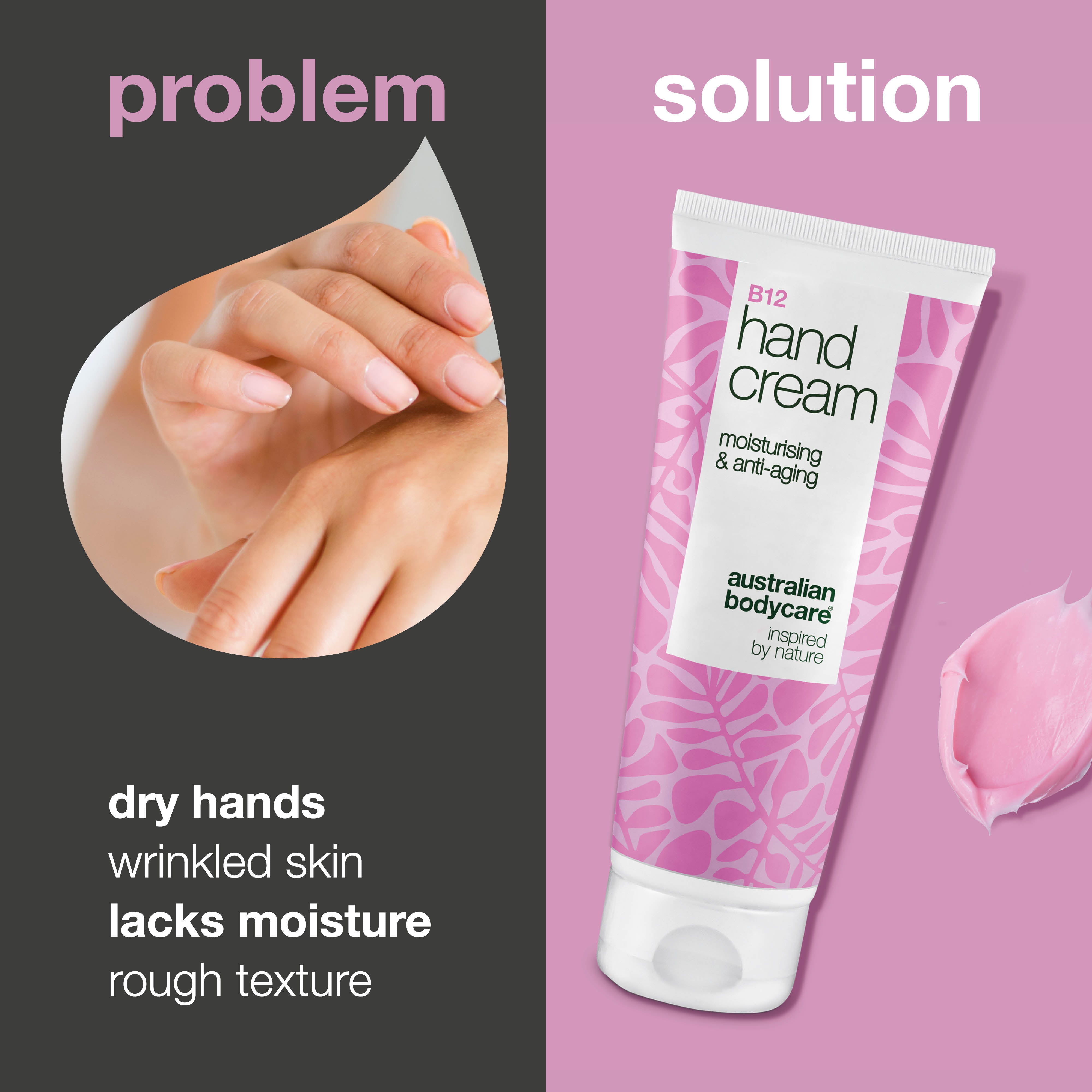 B12 Hand Cream for Dry, Wrinkled Hands – Hydration & Care — Get smooth, youthful hands with B12 Hand Cream. Reduces dryness and wrinkles with intense hydration.