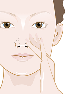 How to remove blackheads