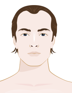 Signs of Male Balding: What to Look For