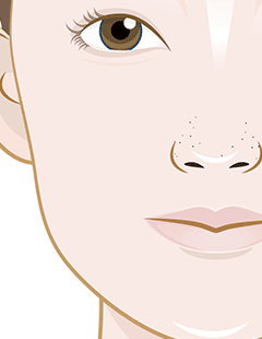 Clogged Pores on Nose? Here’s How to Clear Them