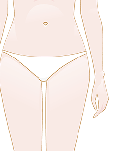 Vulvodynia in the intimate area