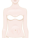 Reduce the visibility of stretch marks on the breasts