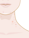 spots on neck