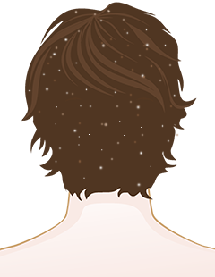 what causes dandruff