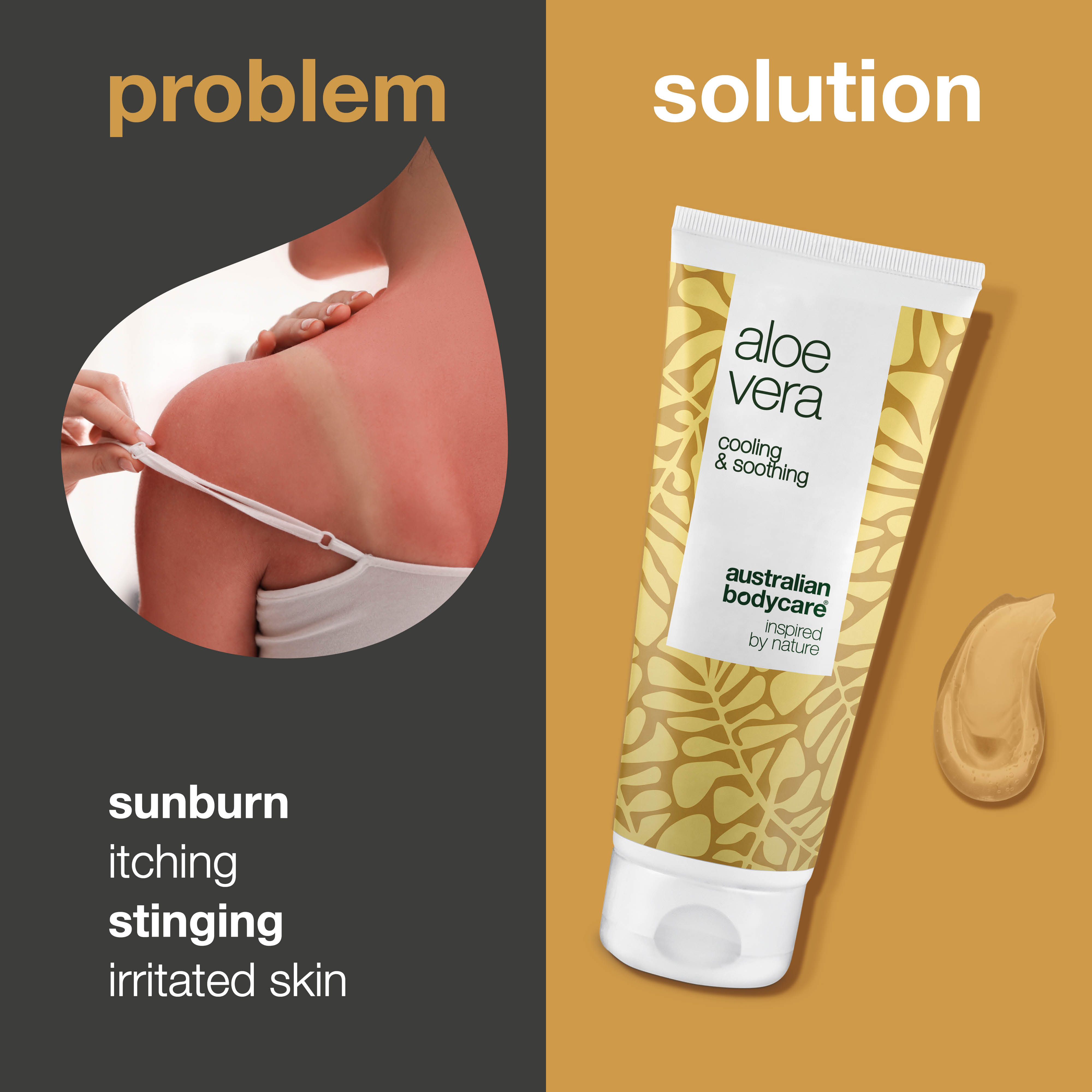 EVERY SKIN Skin gel 150g ✖️3 Aloe Vera Gel – Hydrating care for sunburned and dry skin