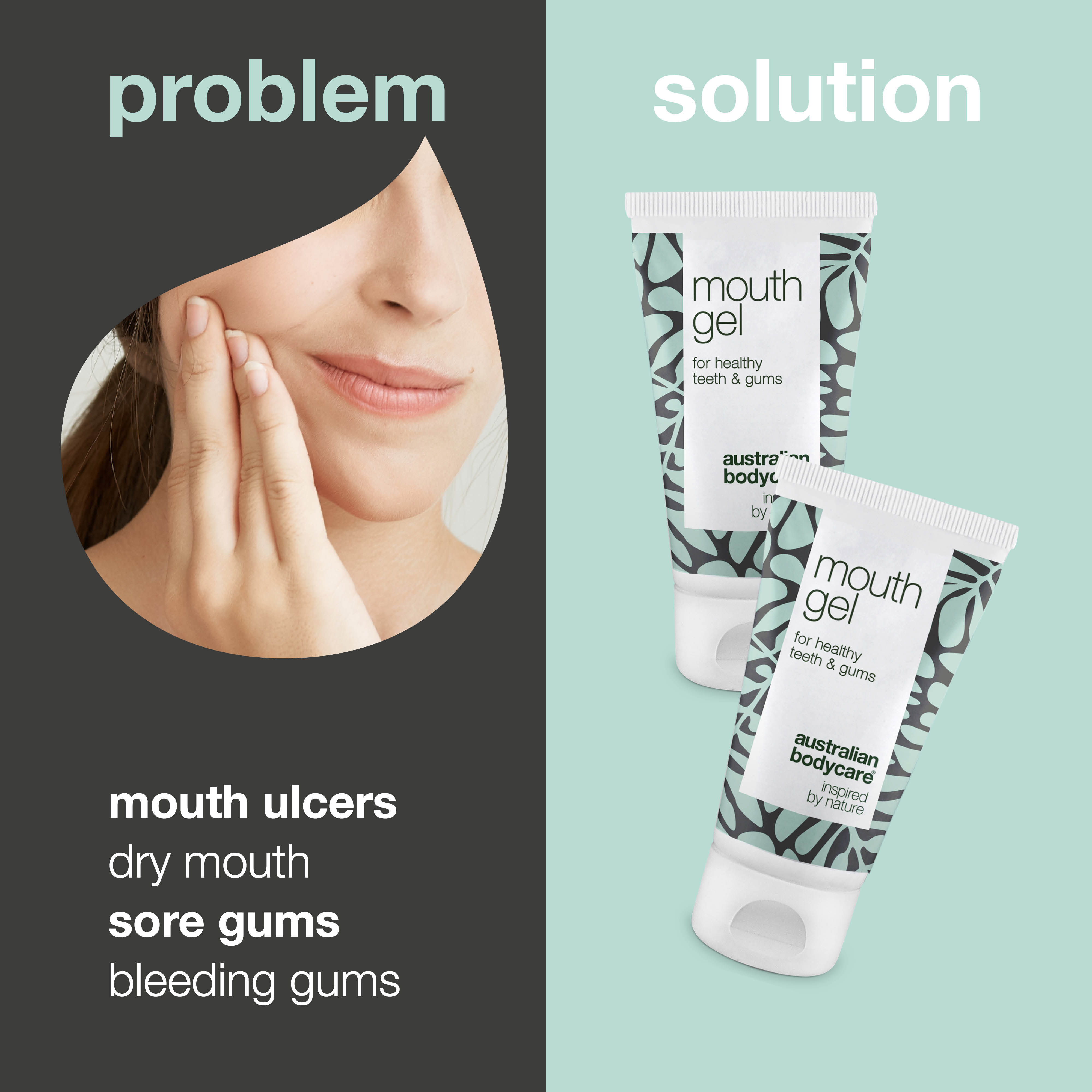 2 x Mouth gel for gums and tongue — For daily care of sore, bleeding gums and oral thrush