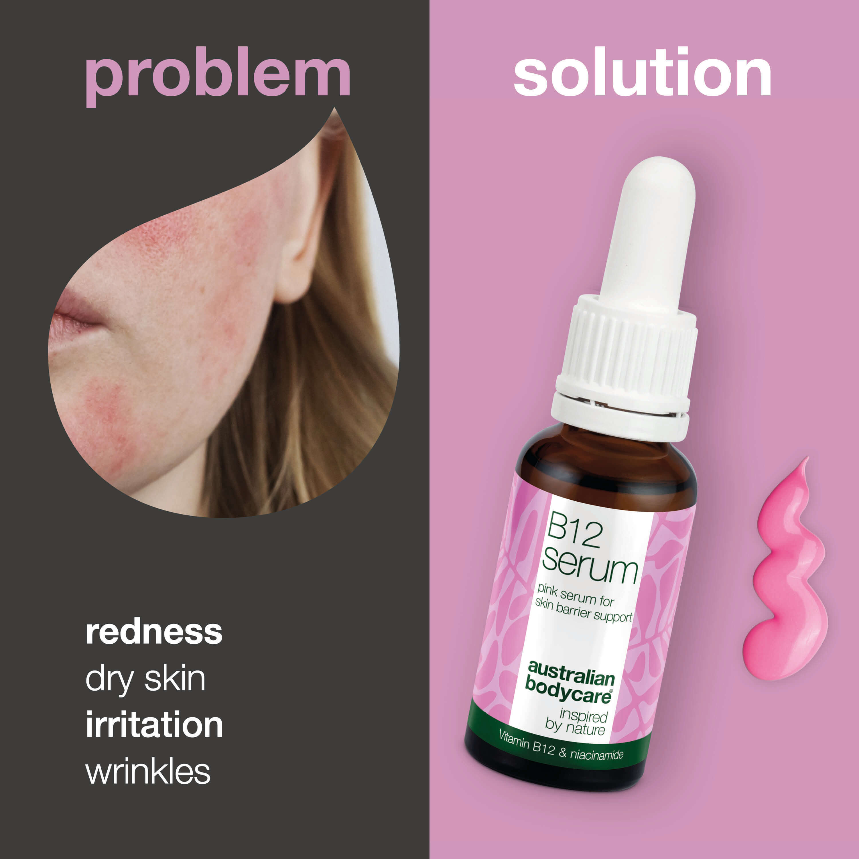 B12 Pink Serum – Reduce Redness and Strengthen Skin Barrier — B12 Serum reduces redness and strengthens the skin barrier. Perfect for dry and sensitive skin. Experience radiant and healthy skin.