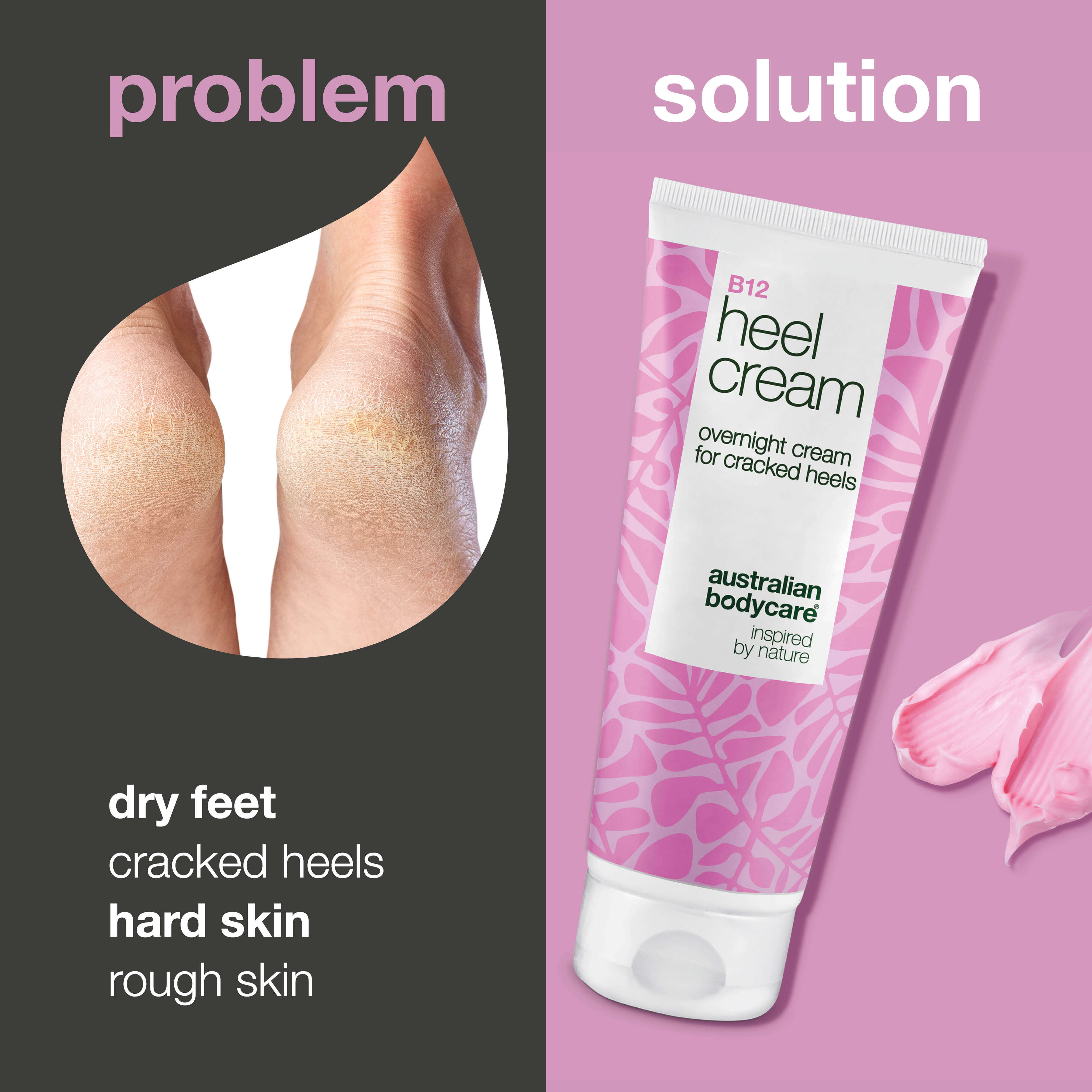 Heel Cream for Dry Feet, Cracked Heels & Hard Skin
