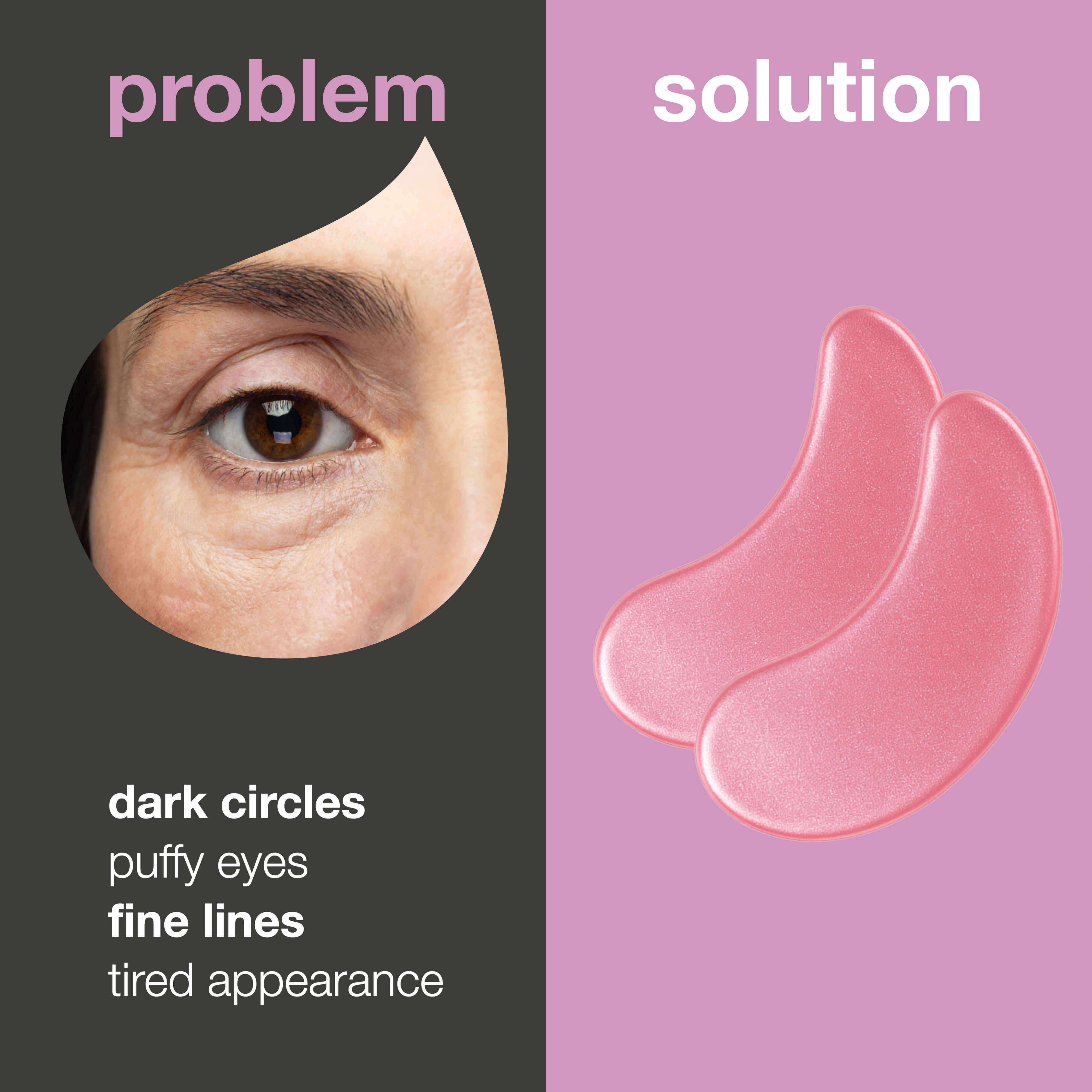 B12 Vitamin Under Eye Patches with Collagen for Dark Circles & Puffiness — Reduce dark circles with B12 eye masks. Hydrates and refreshes the skin in just 20 minutes. Perfect for tired eyes!