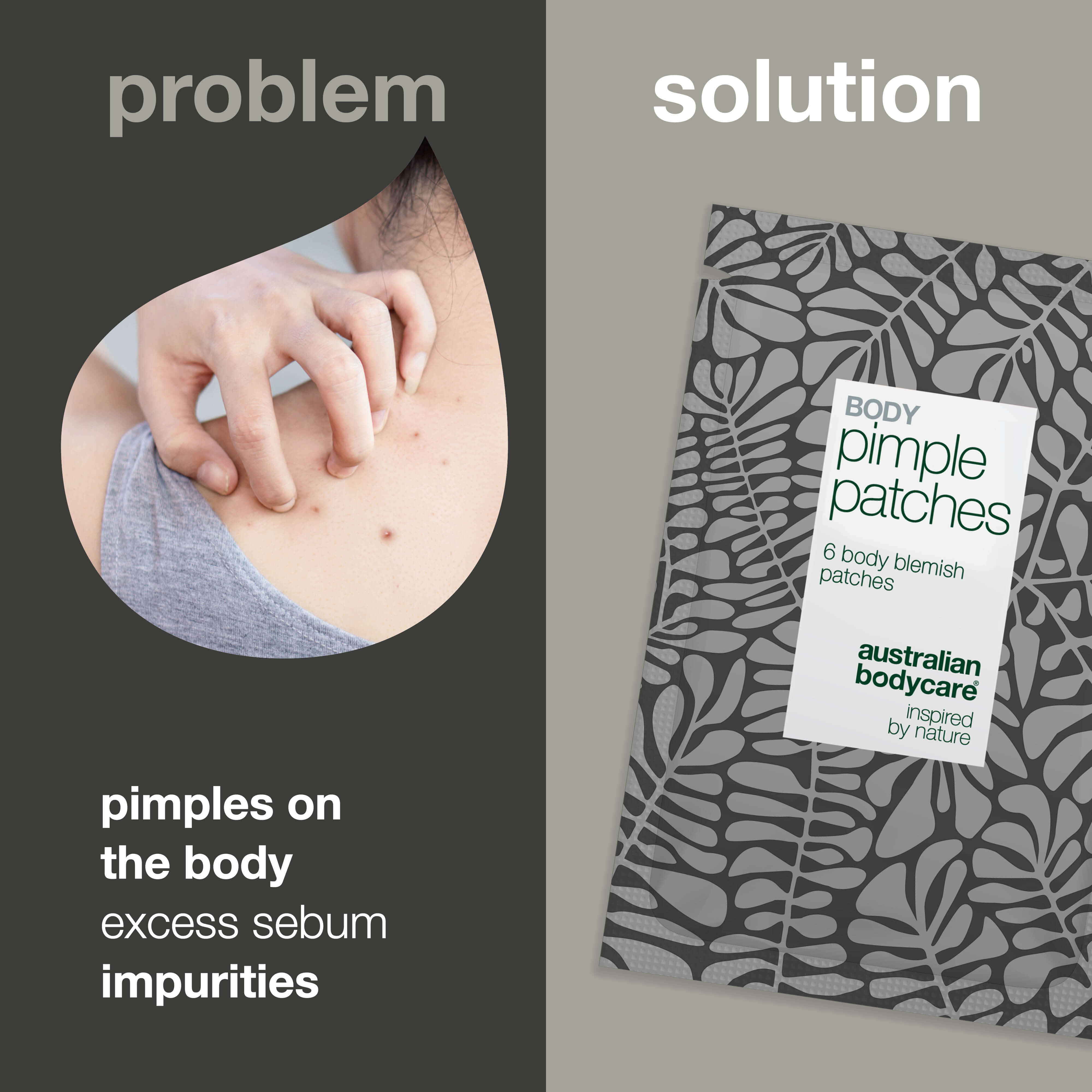 Body Pimple Patches – Spot Treatment for Back & Chest — Fast-acting pimple patches for back, chest & shoulders. Absorbs oil, protects skin & reduces breakouts. Perfect for body blemishes.