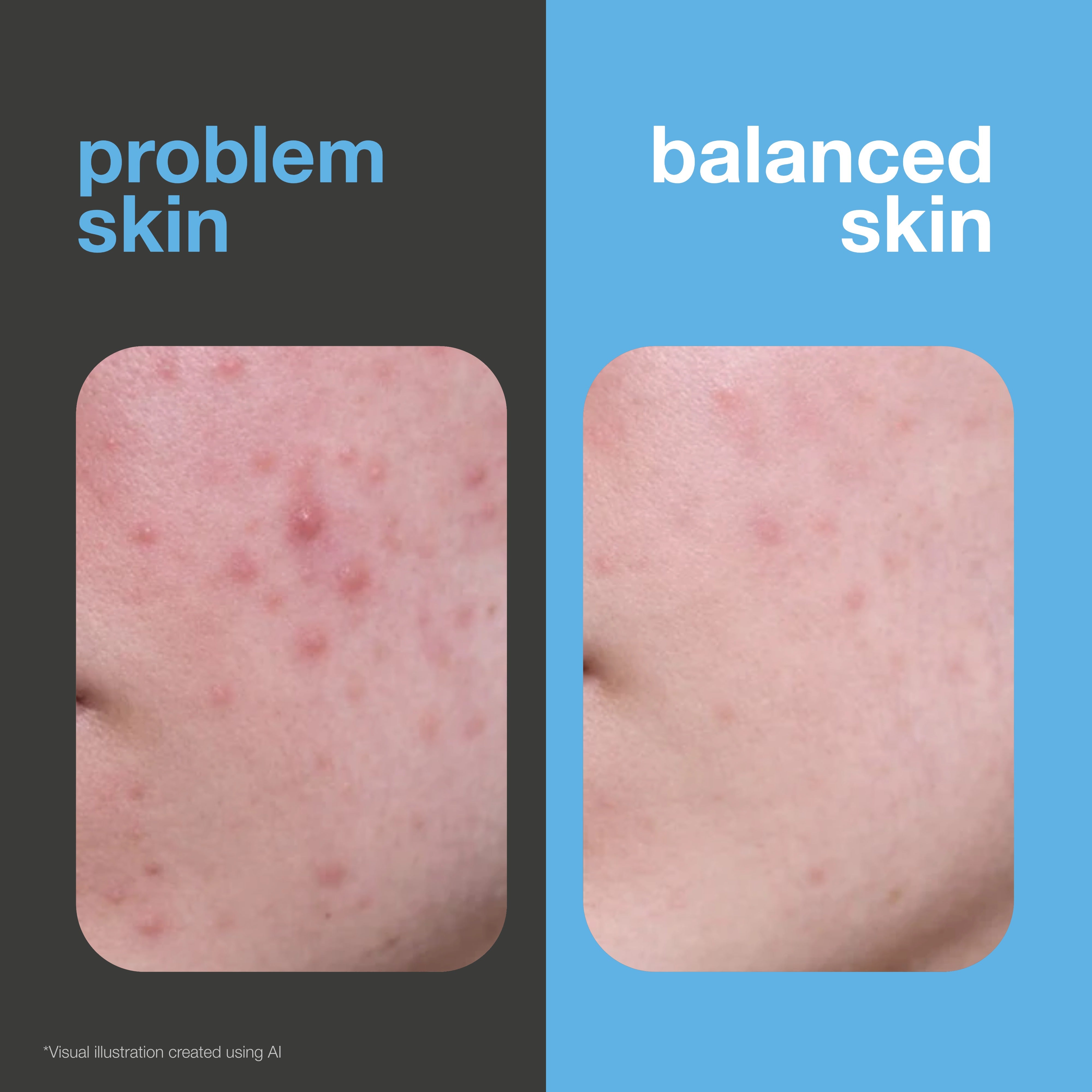 Before and after: face with spots and redness versus clearer, more balanced skin. Visual illustration.