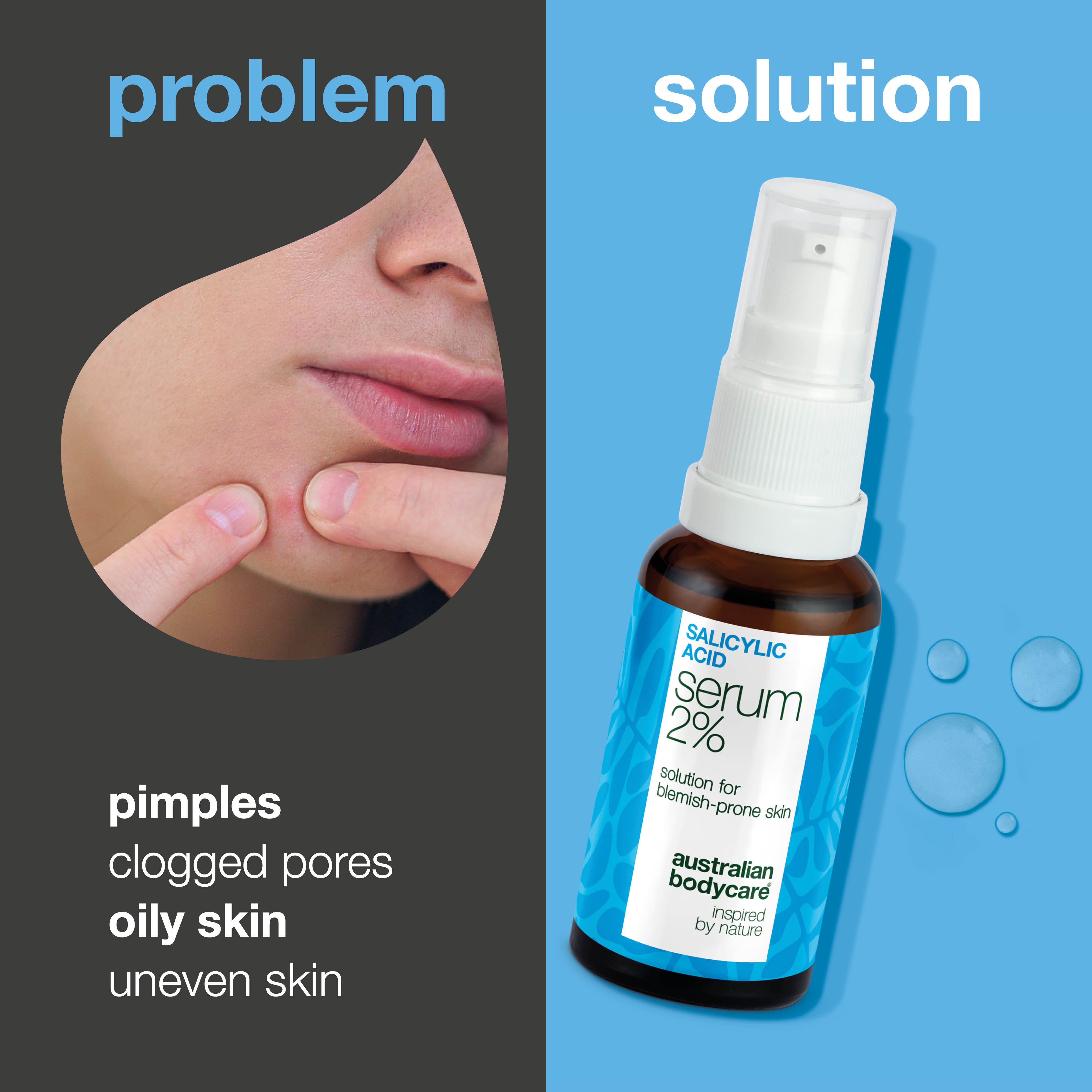 Salicylic Acid 2% Serum for Oily Skin, Blackheads & Blemish Control