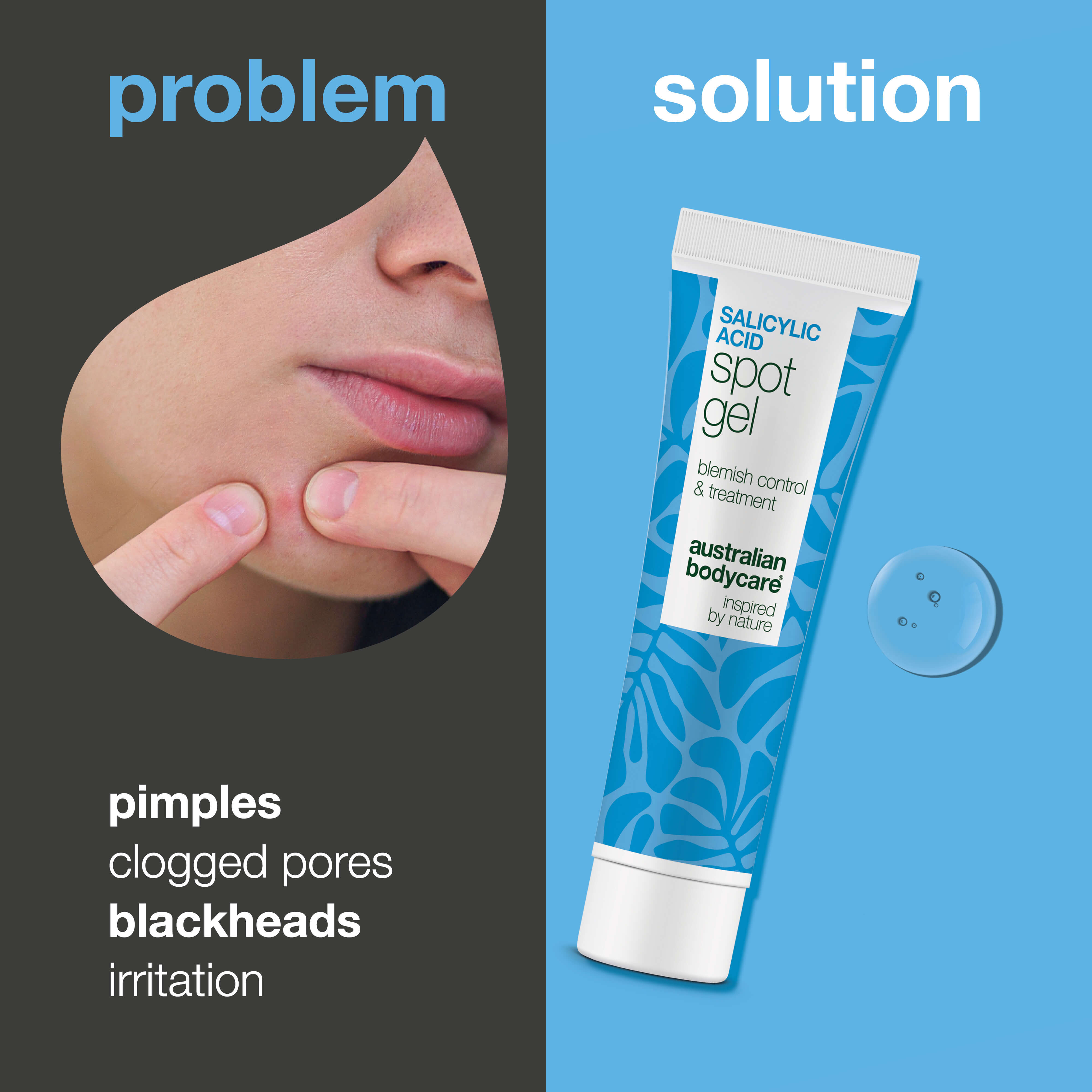 Salicylic Acid Spot Gel for blemishes and clogged pores — Salicylic Acid Spot Gel clears uneven, oily skin. Removes dead cells and excess oil with effective Salicylic Acid care.