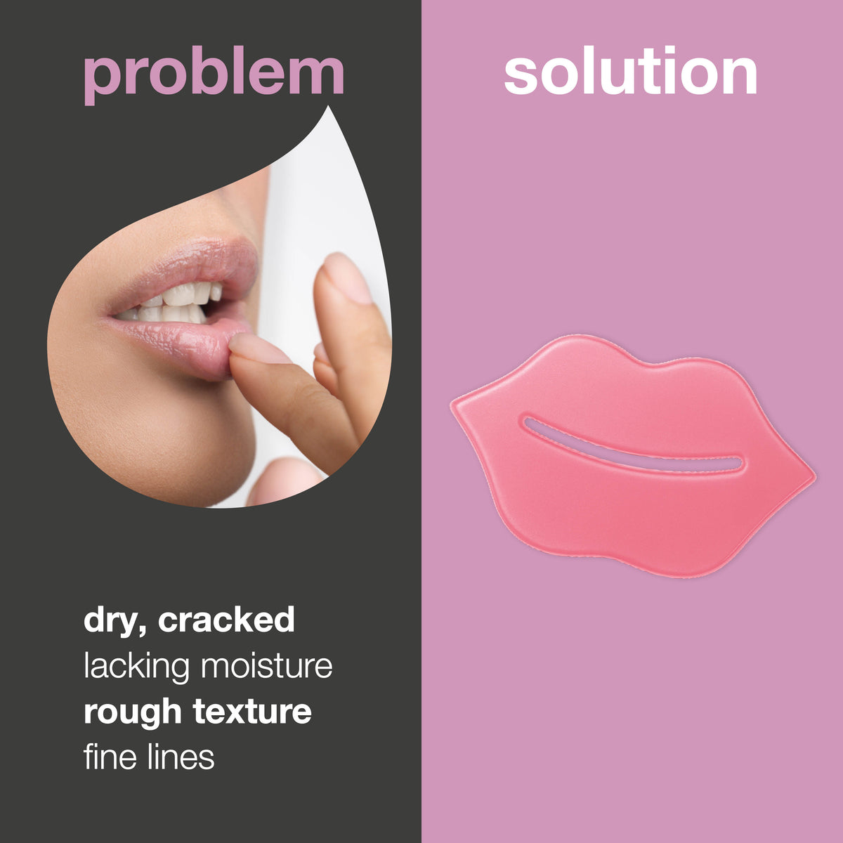 Muach Lips Lip Mask for Dry, Chapped Lips and Fine Lines – with B12 and Collagen