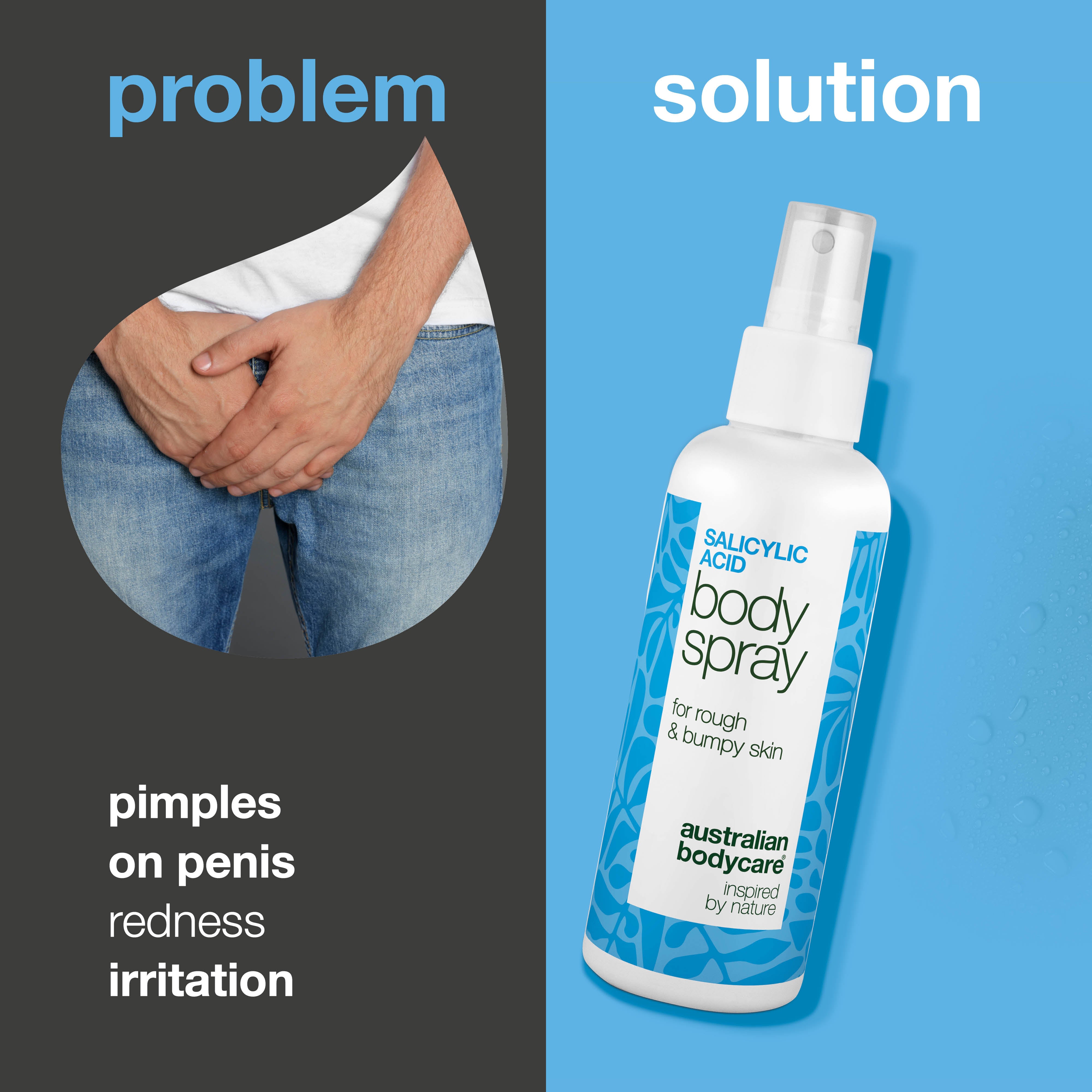 Spray to treat pimples on penis clears clogged pores and prevents new breakouts. Contains salicylic acid, glycolic acid, panthenol, glycerin and zinc.