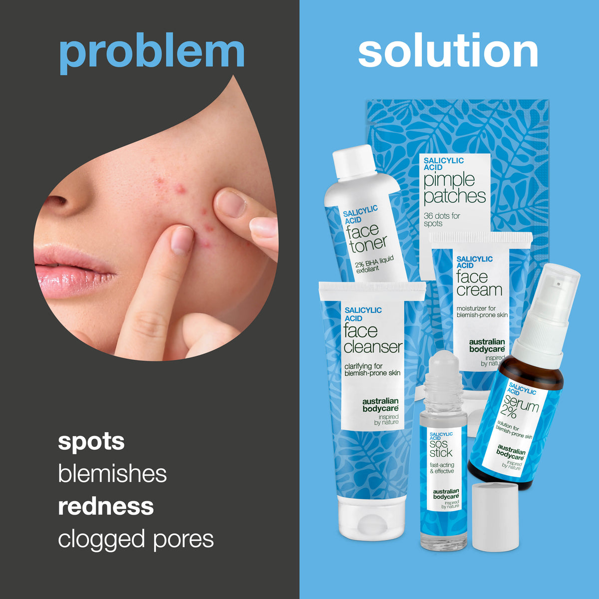 Spot Kit Spot stick for pimples | Remove your spots today | Australian bodycare