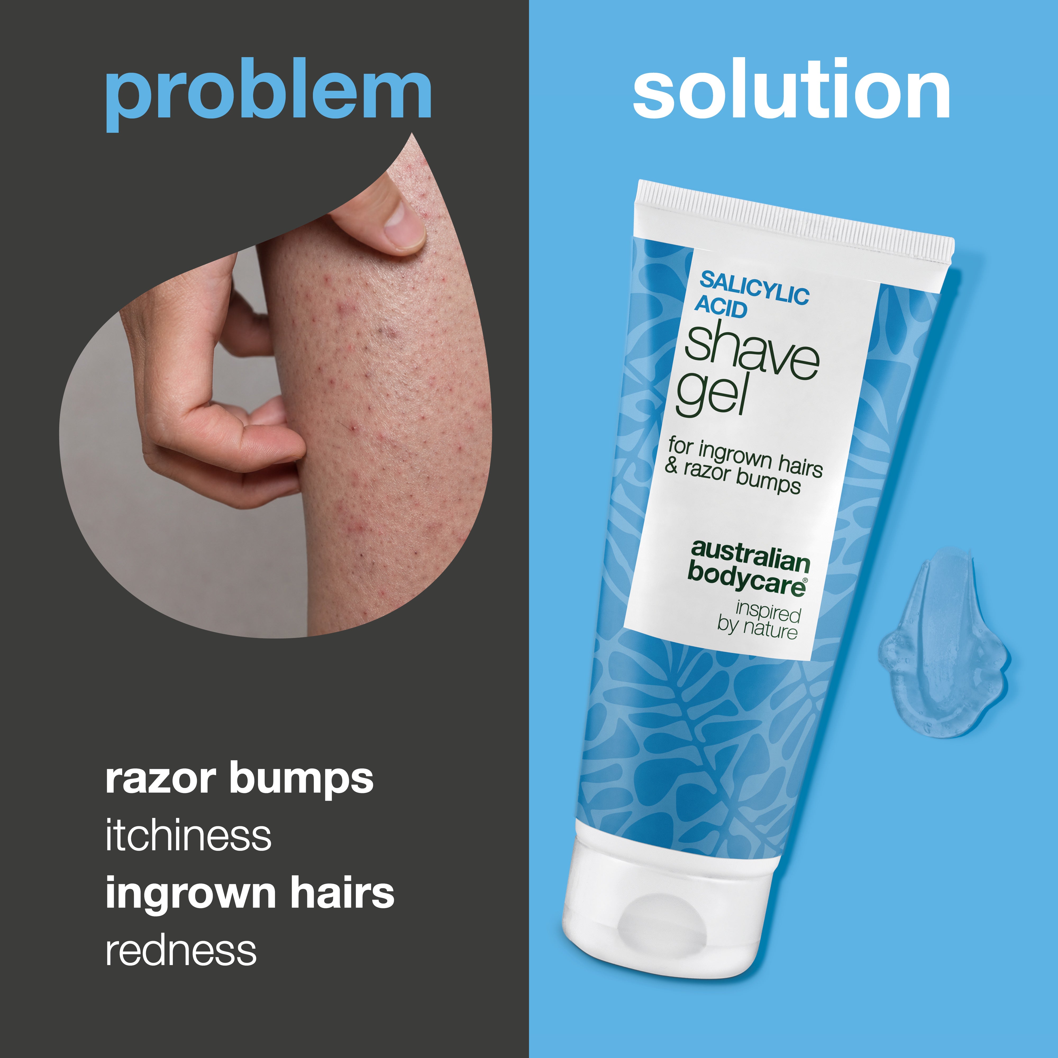 Salicylic Acid Shave Gel – Stop Ingrown Hairs & Bumps — Salicylic Acid Shave Gel prevents ingrown hairs and itch. Enriched with Salicylic acid, Glycerin, and Panthenol for irritation-free skin.