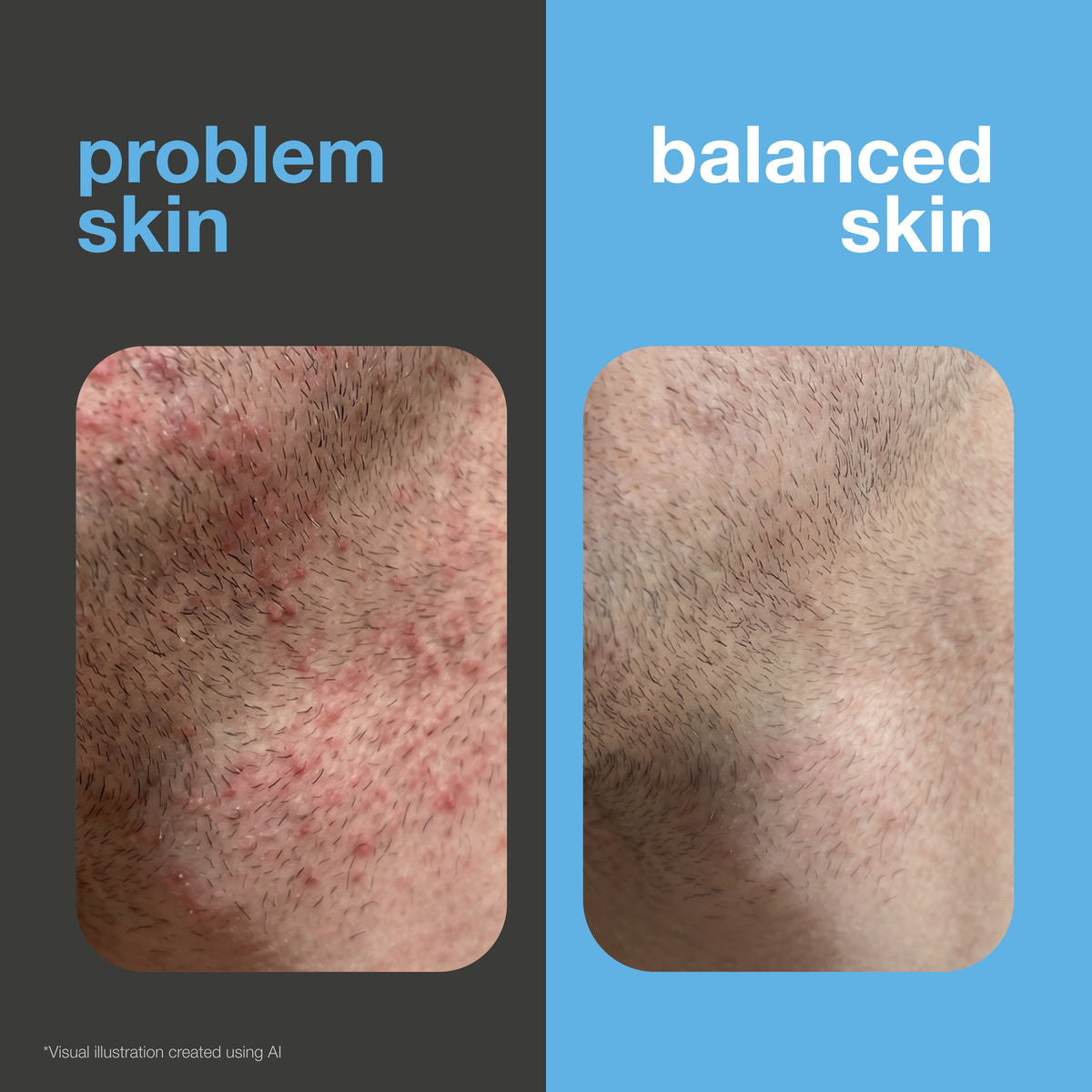 Before and after: shaved skin with razor bumps and irritation versus smooth, soothed skin. Visual illustration.