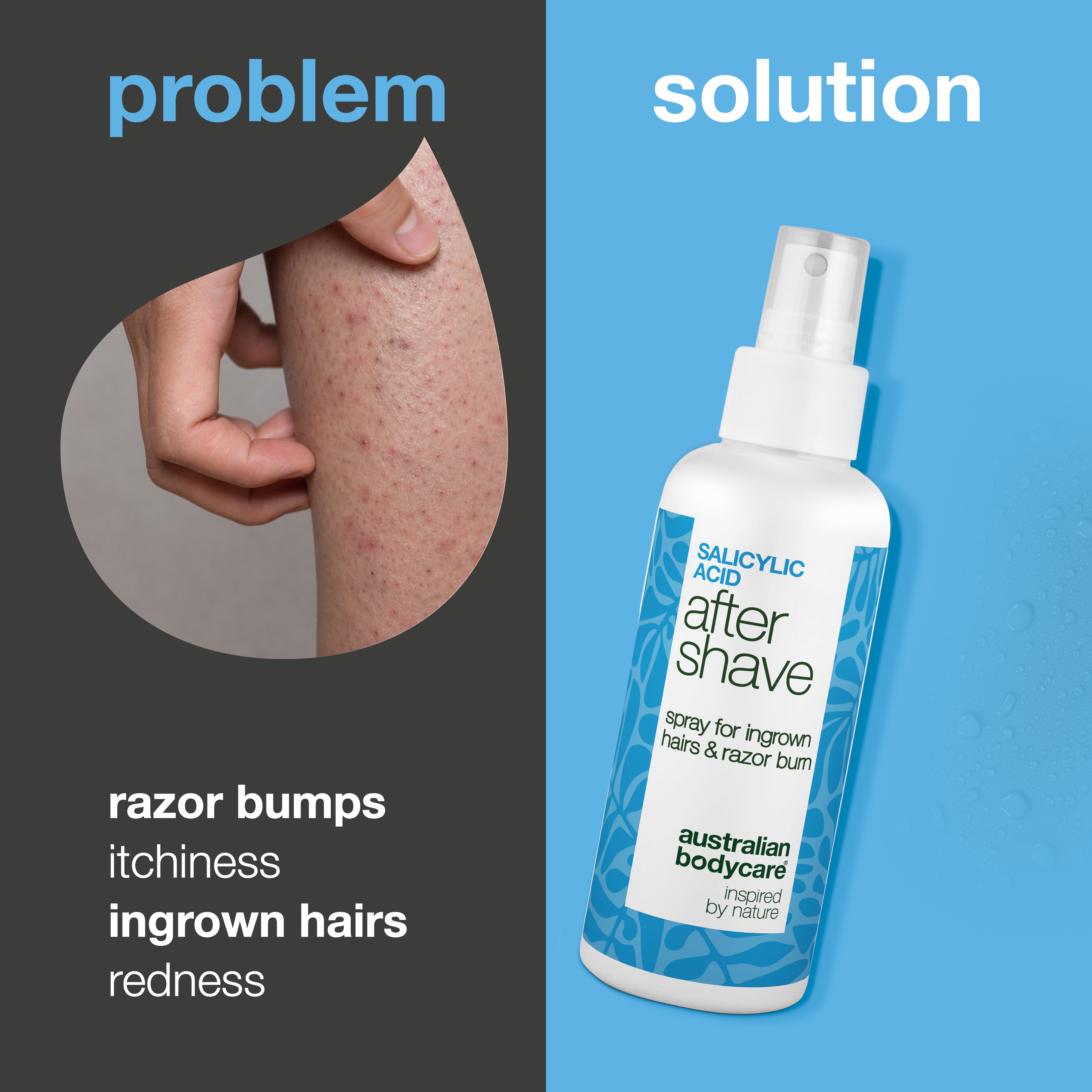 Salicylic Acid After Shave Spray for Razor Bumps — After Shave Spray for razor burns and ingrown hairs. Soothes itching with Salicylic Acid, Aloe Vera, and Panthenol for a smooth finish.