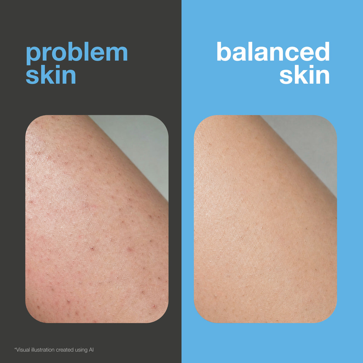 Before and after: shaved skin with razor bumps and irritation versus smooth, soothed skin. Visual illustration.