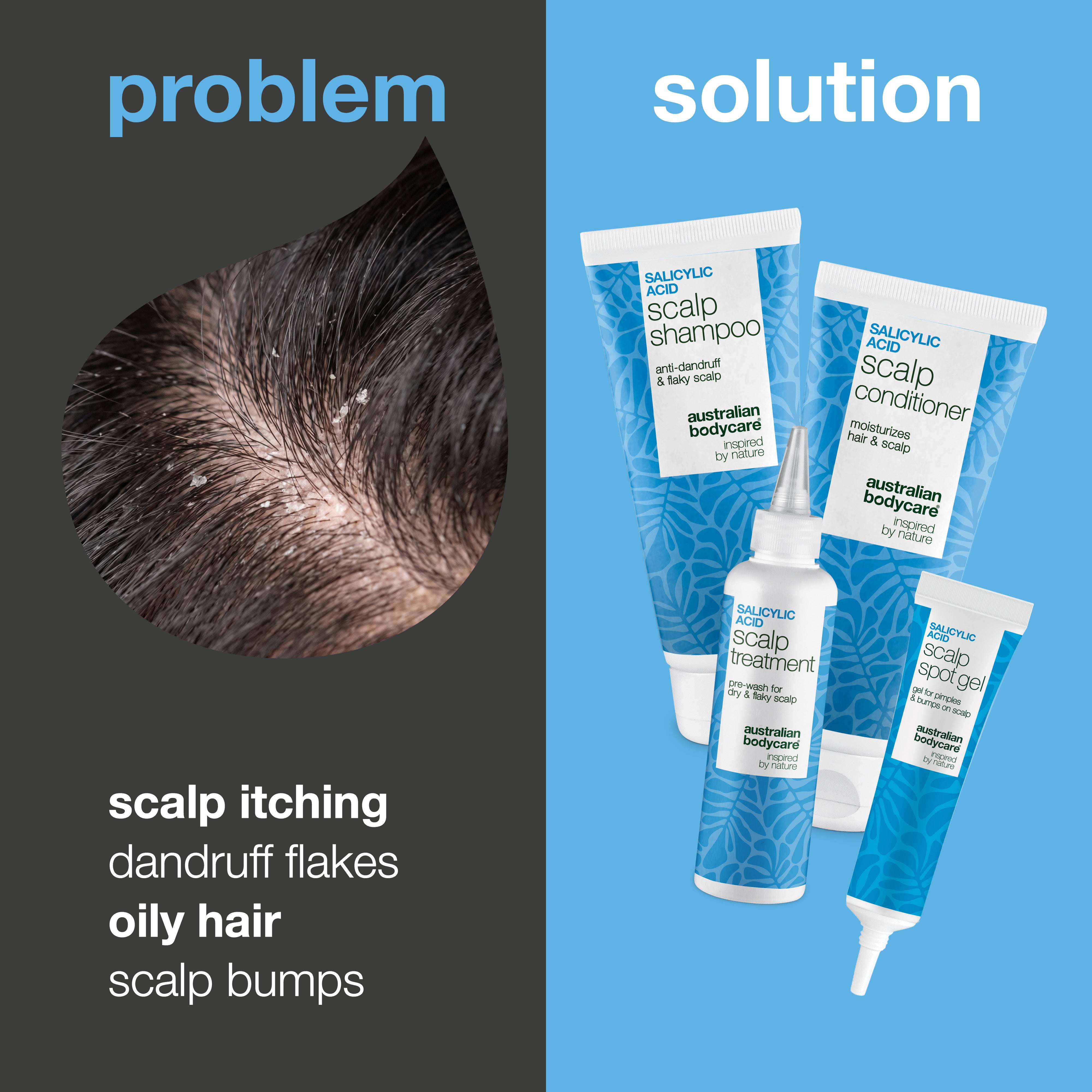 Problem and solution: close-up of dandruff and flaky scalp next to the four scalp care products for itch, dandruff and pimples
