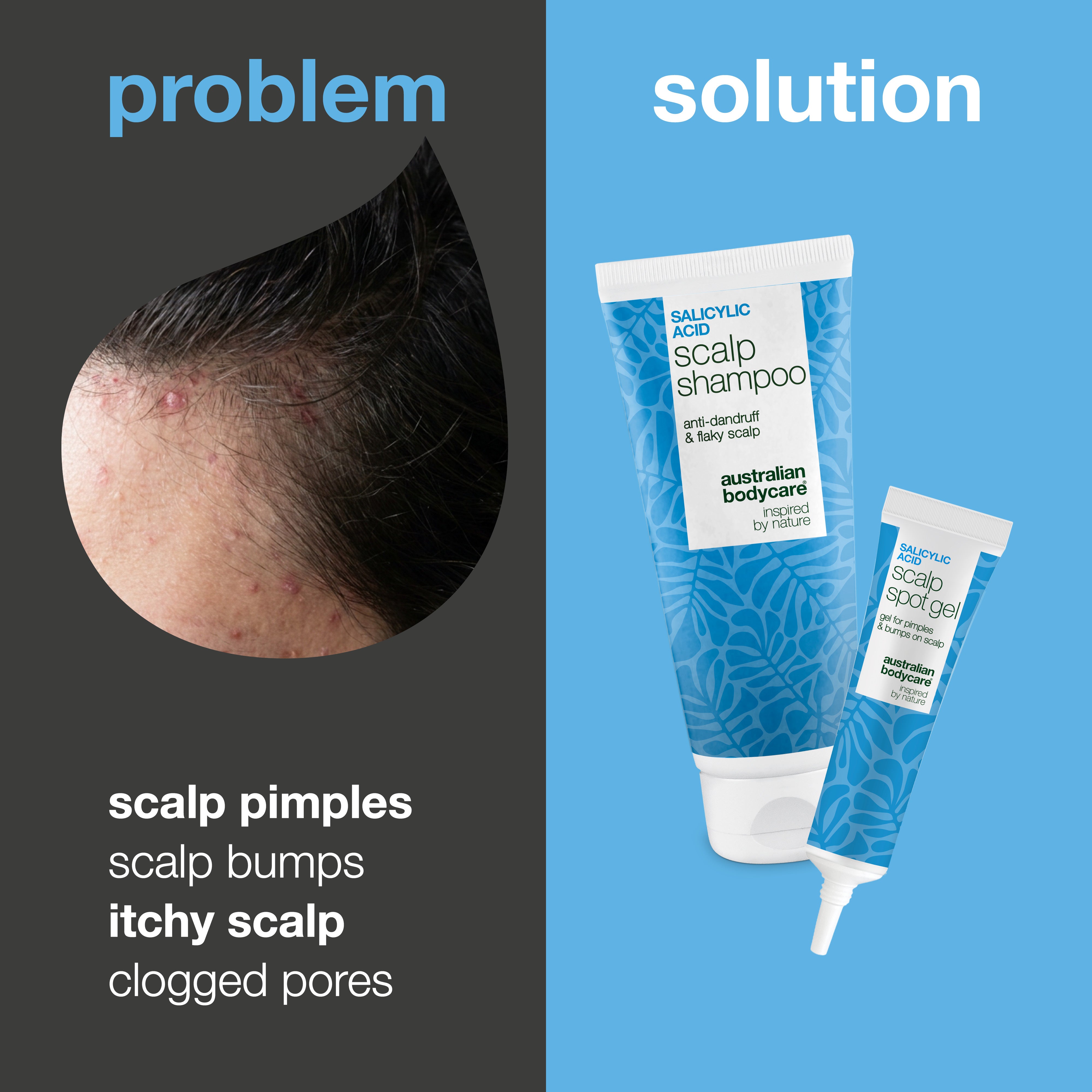 Problem and solution: close-up of pimples and sore bumps on the scalp next to the set of shampoo and spot gel