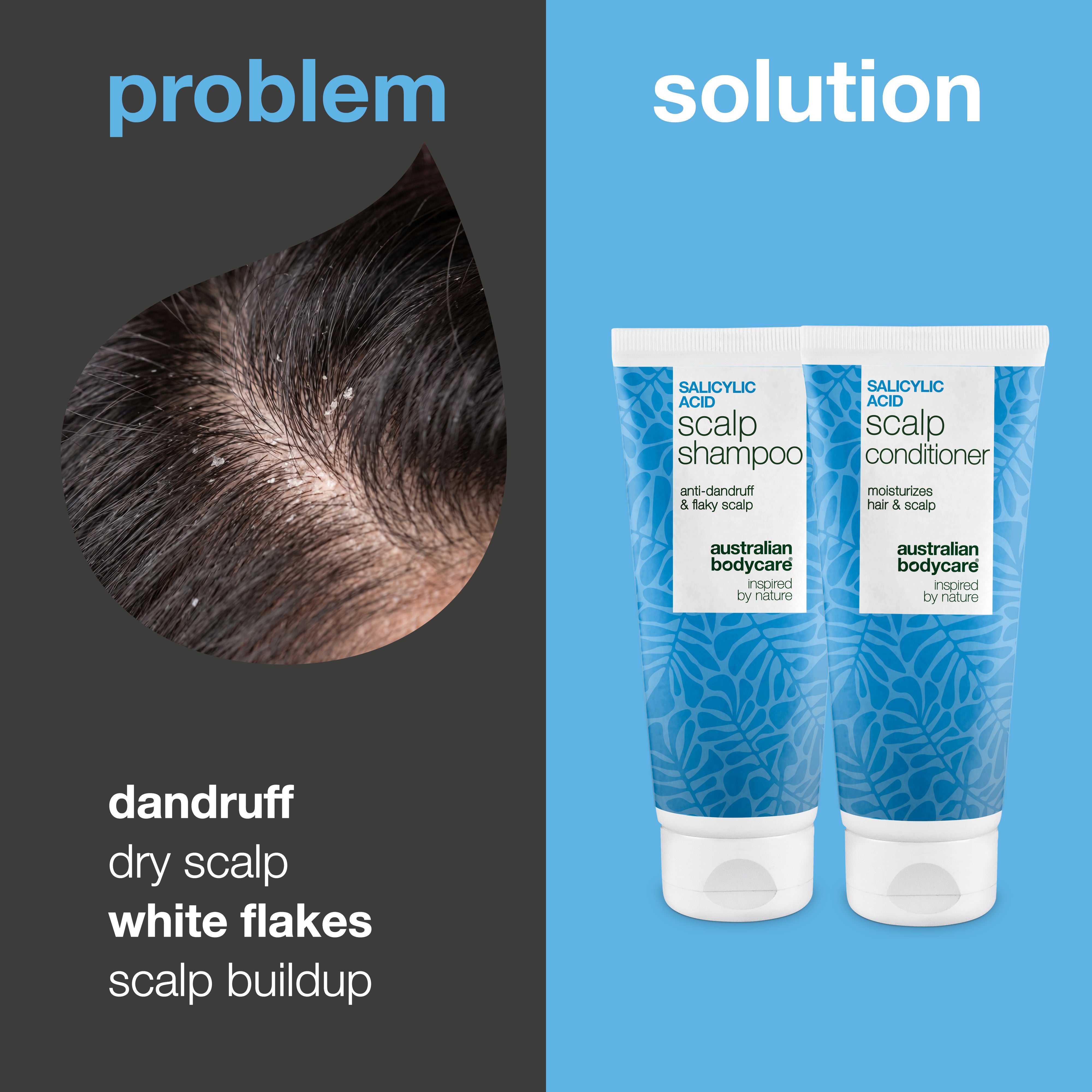 Problem and solution: close-up of dandruff and white flakes on the scalp next to the kit's scalp shampoo and conditioner