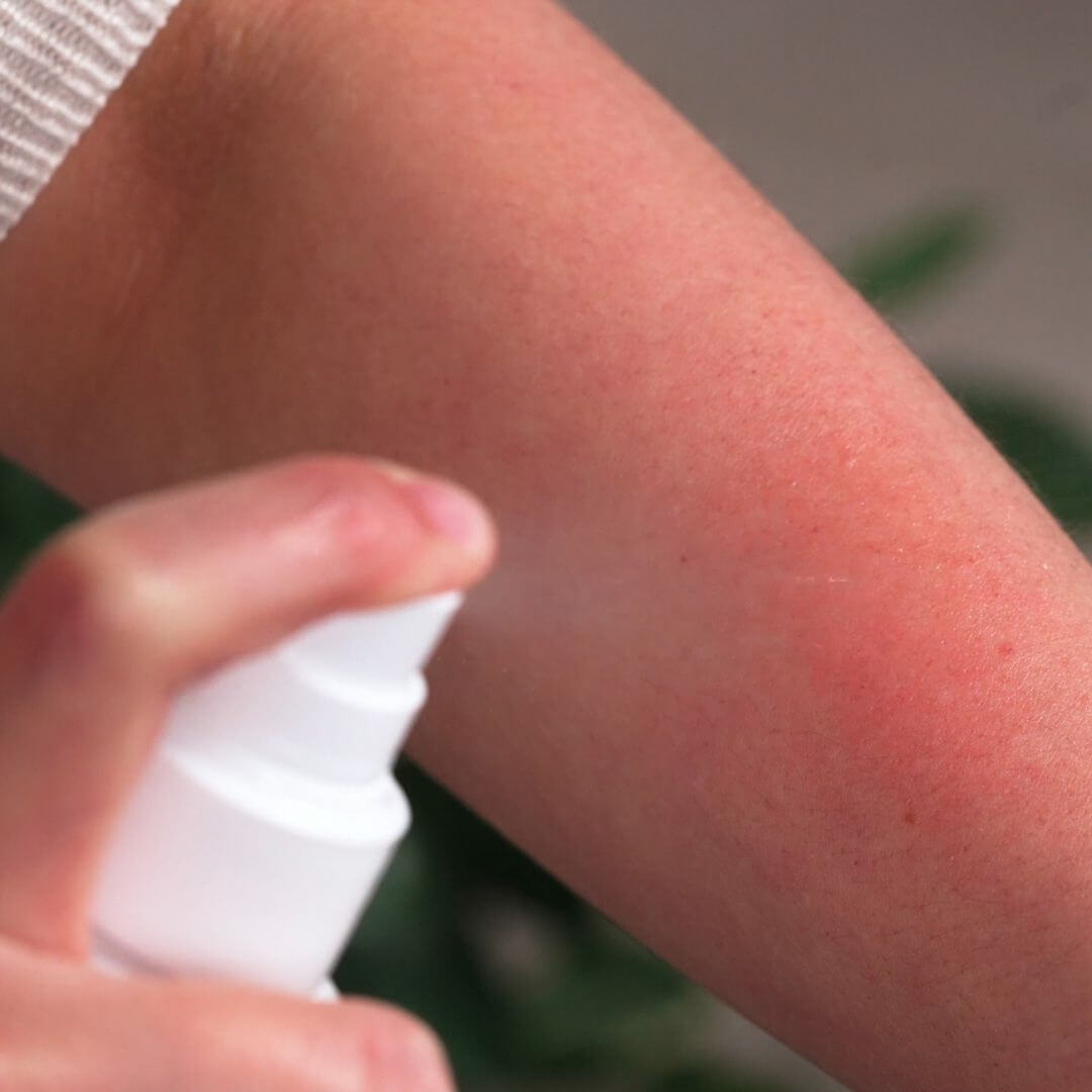 Set for itchy skin itching caused by chickenpox — 3 products for the care of rashes and itching caused by chicken pox