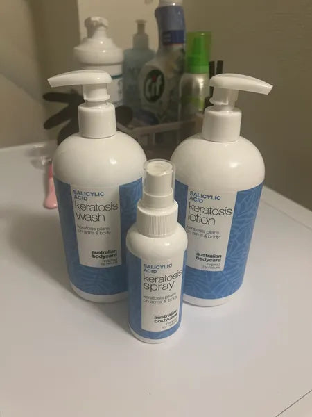 Keratosis pilaris customer result – Isabell C. from Netherlands