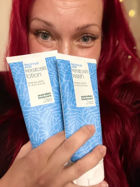 Keratosis pilaris customer result – Viktorija K.